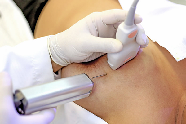 Foto com direitos de autor