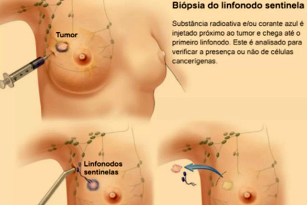 Foto com direitos de autor