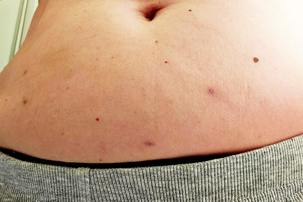 Aprender a viver com a dor 🥹